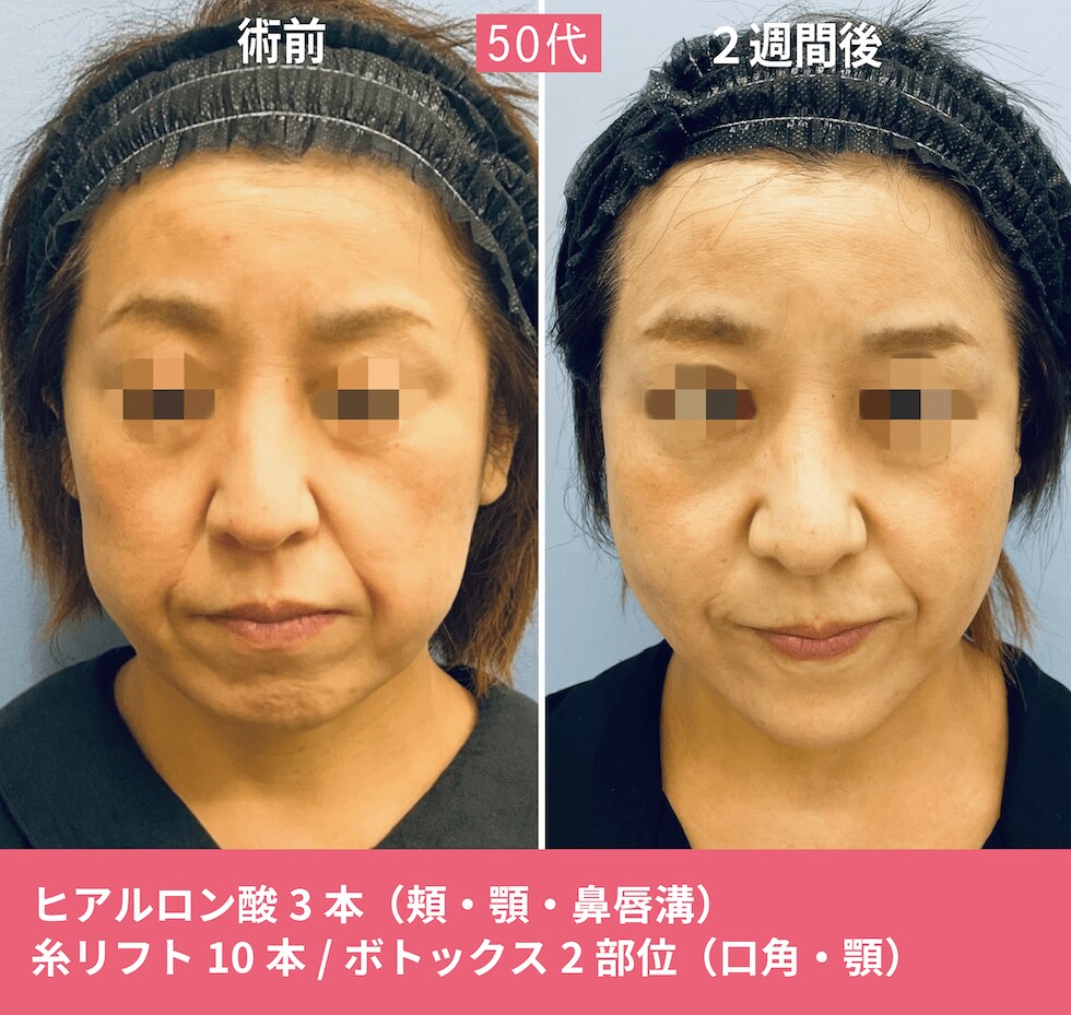 症例