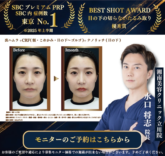 若返り