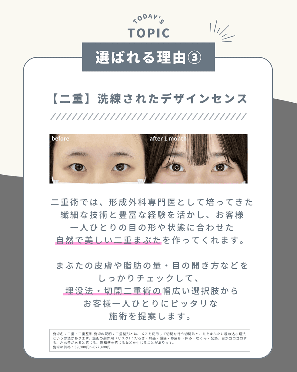 選ばれる理由