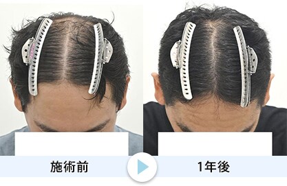症例写真1