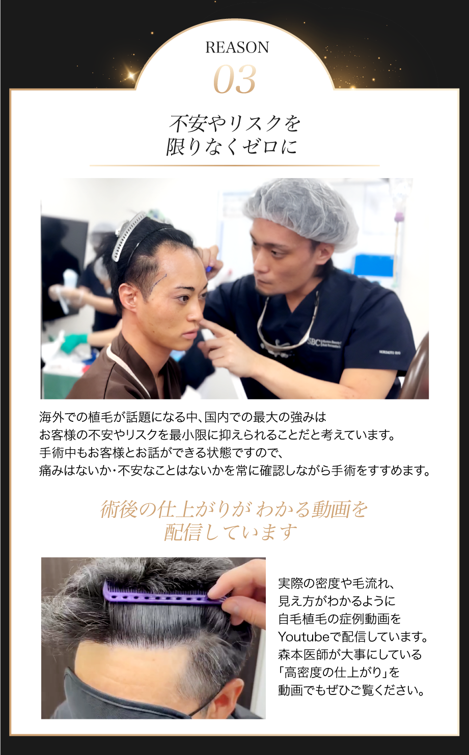 選ばれる理由