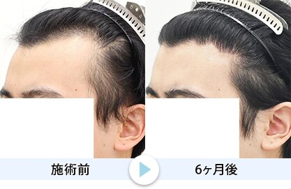 症例写真1