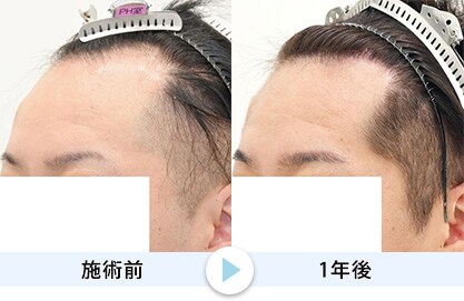 症例写真1