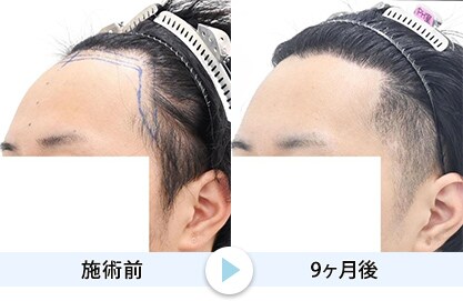 症例写真1
