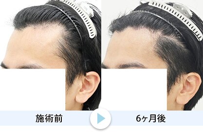 症例写真1