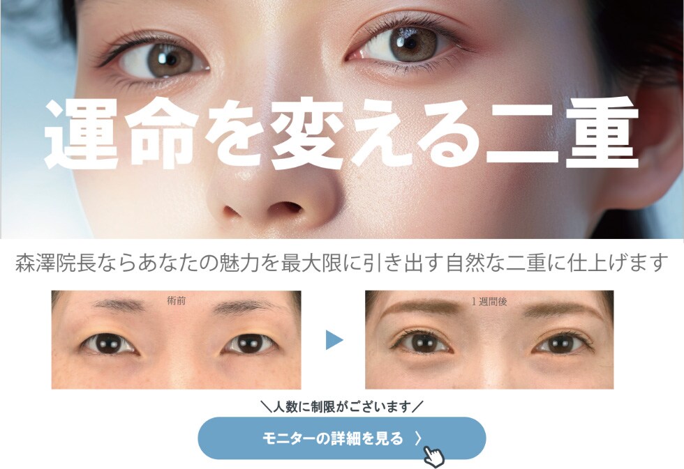 二重埋没法モニター募集