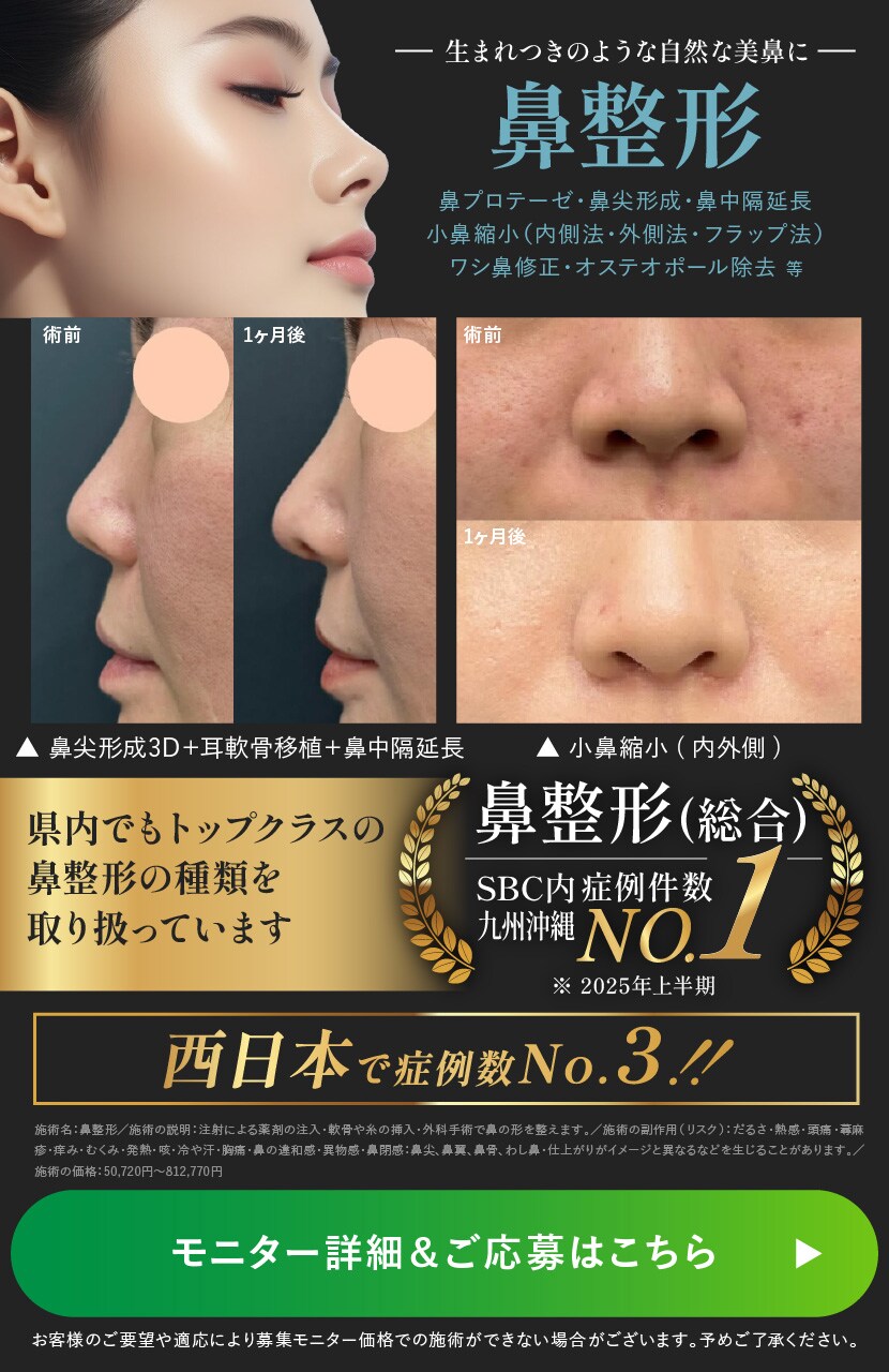 鼻モニター募集中