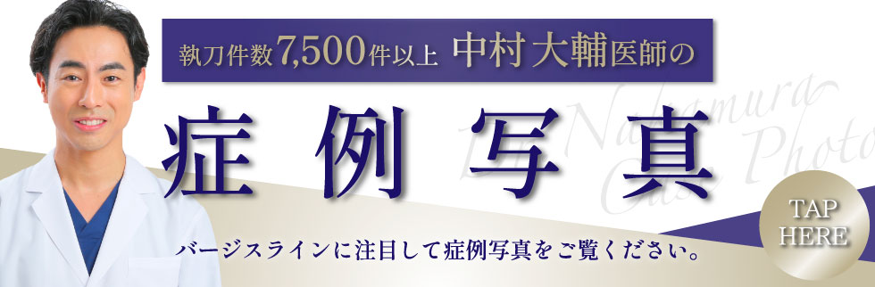 豊胸モニターバナー