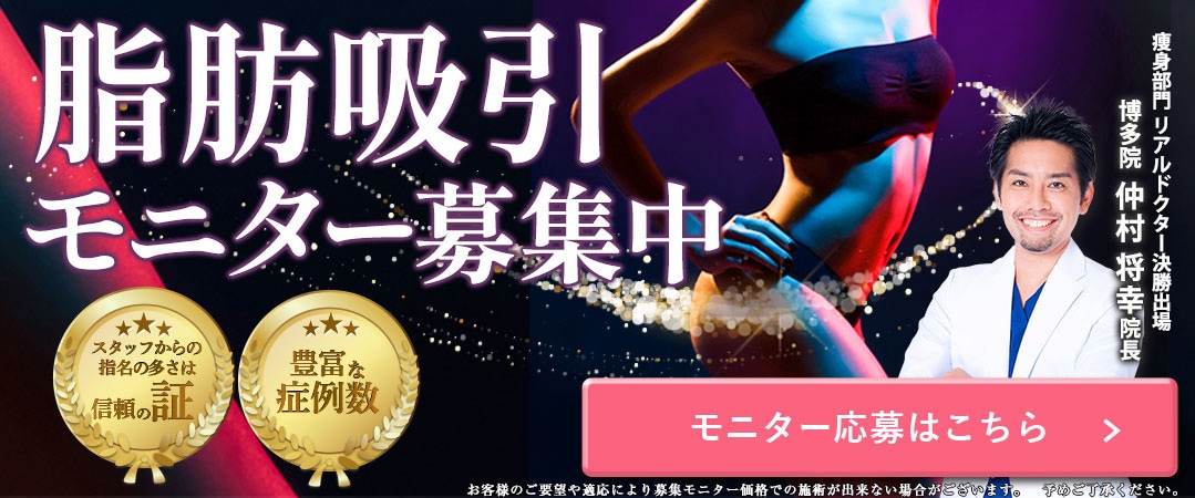 脂肪吸引モニター募集