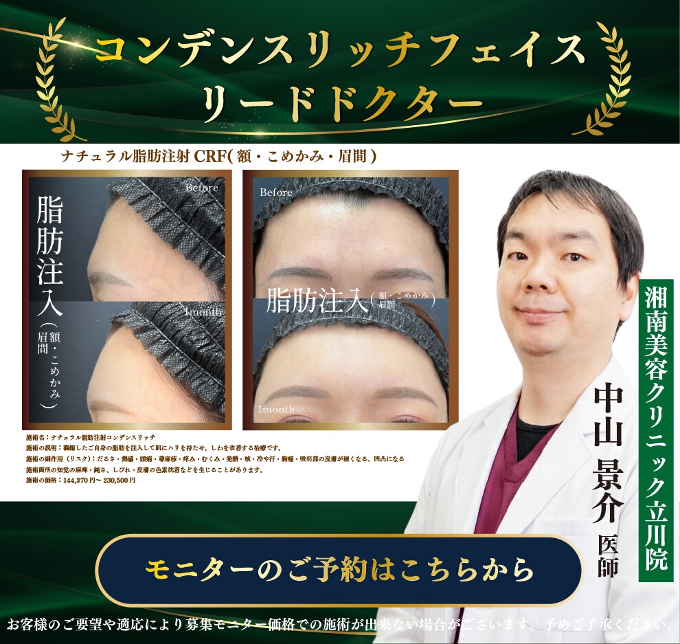 若返り