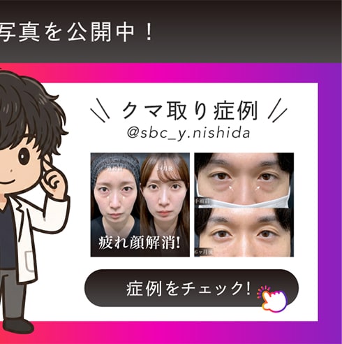 Instagram クマ取り