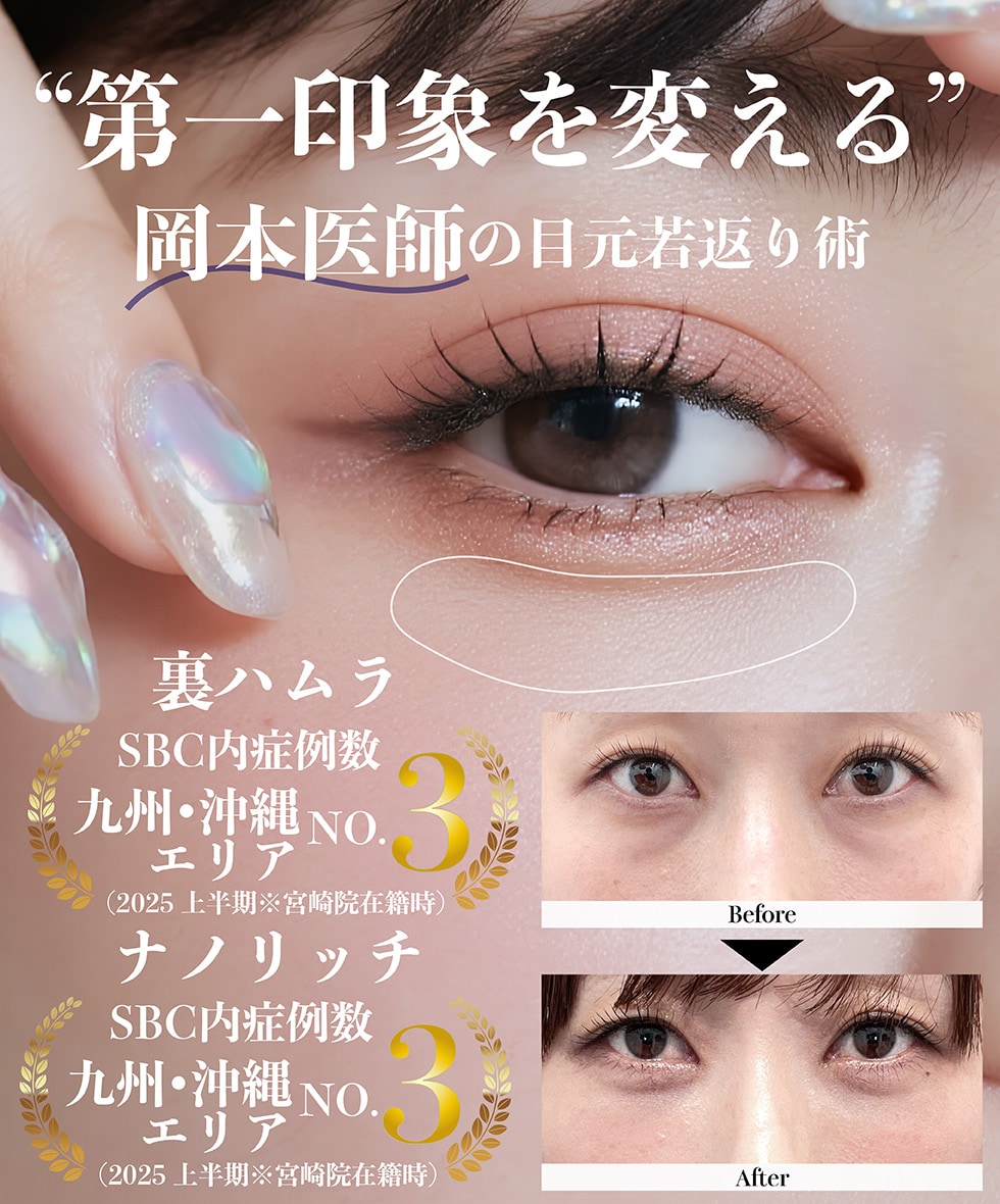 目元整形特集