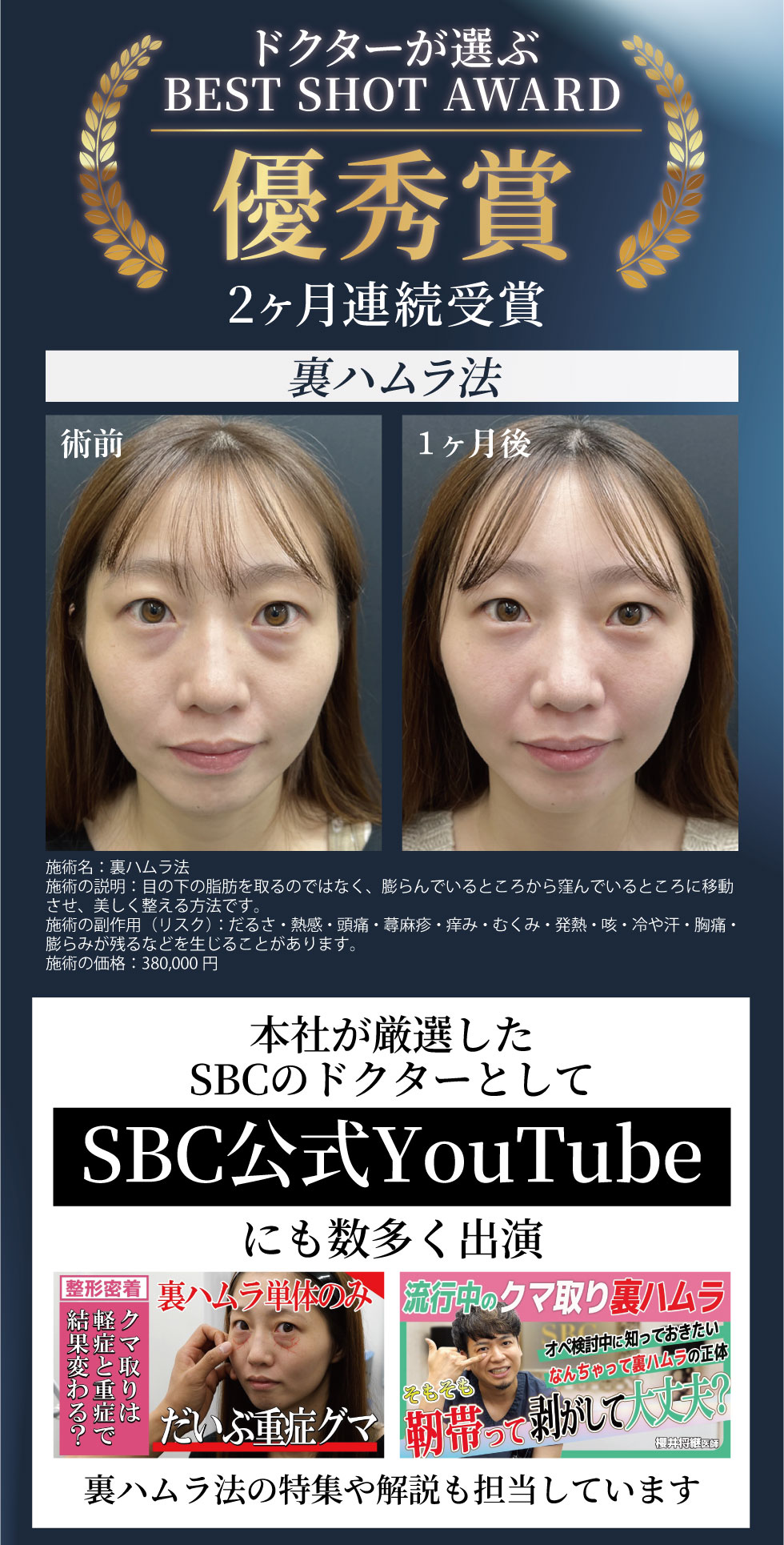 裏ハムラ