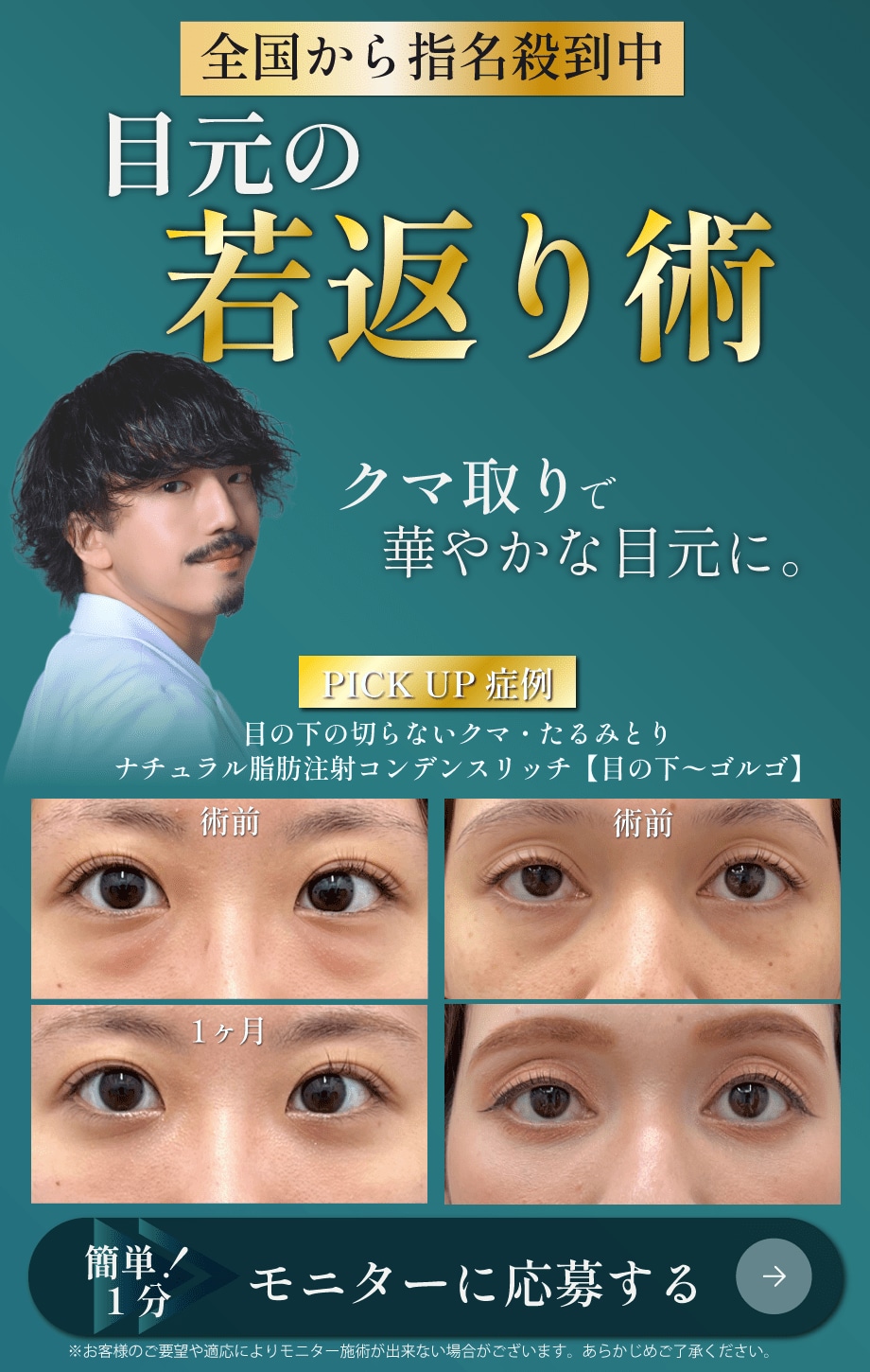 若返り術モニター《目元》