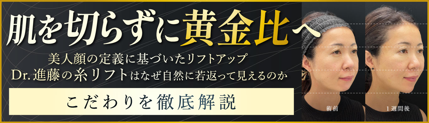 糸リフト