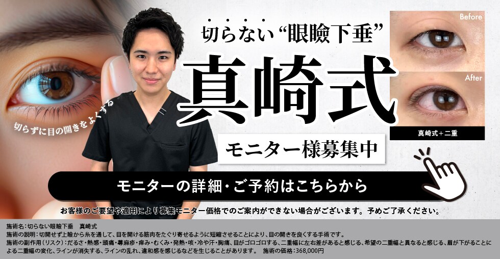 モニター募集