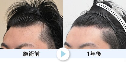 症例写真1