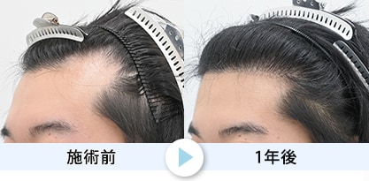 症例写真1