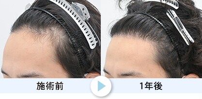 症例写真1