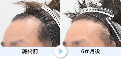 症例写真1