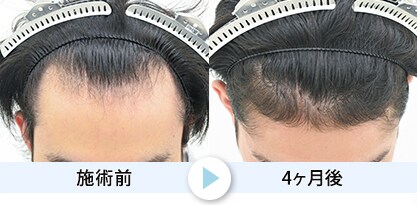 症例写真1
