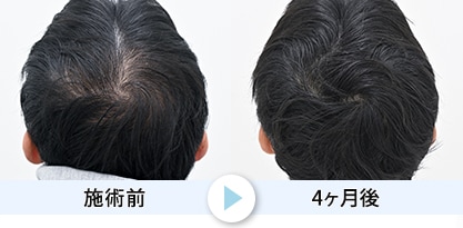 症例写真1