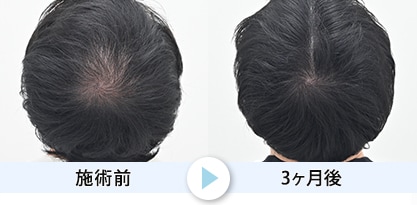 症例写真1