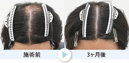 症例写真1