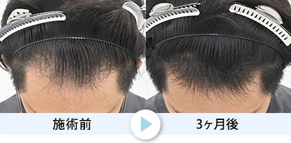 症例写真1