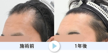 症例写真1