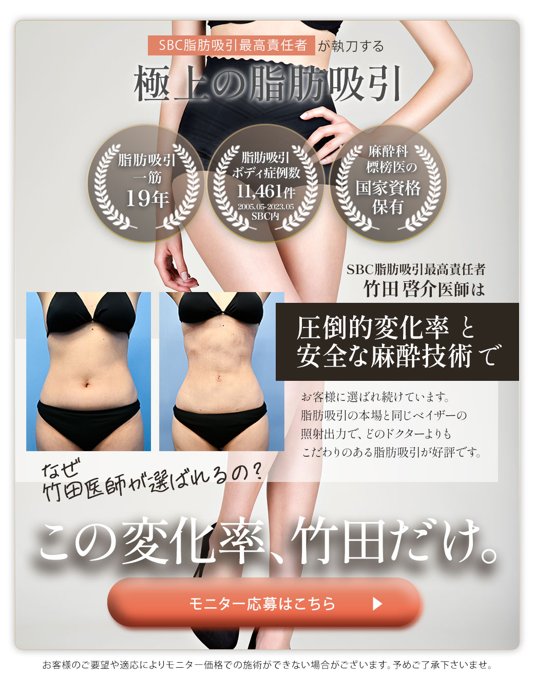 根こそぎ脂肪吸引モニター予約