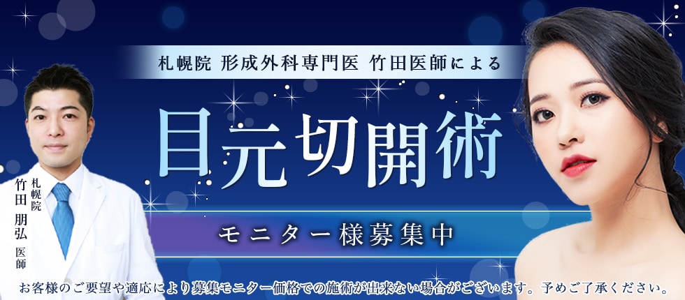 目元切開術モニター募集