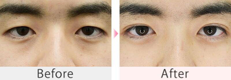 症例写真