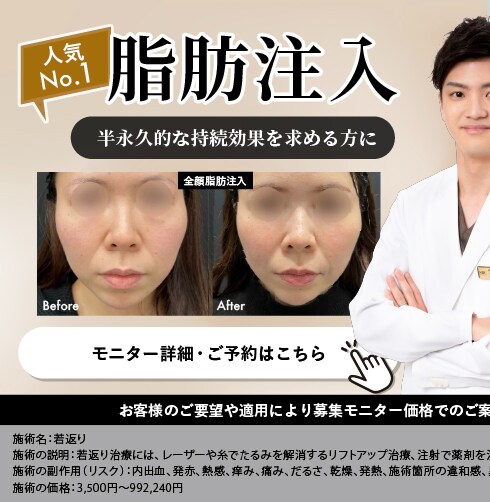 脂肪注入