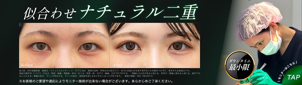 二重