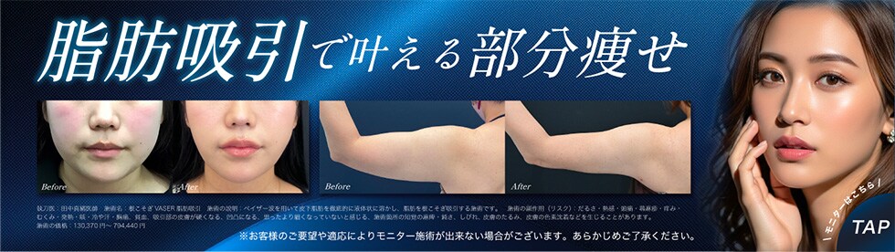 脂肪吸引