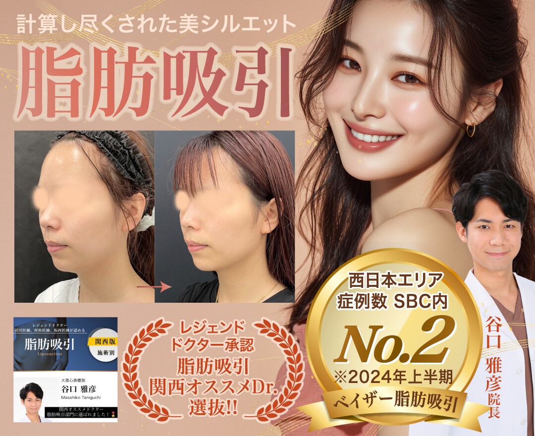 脂肪吸引