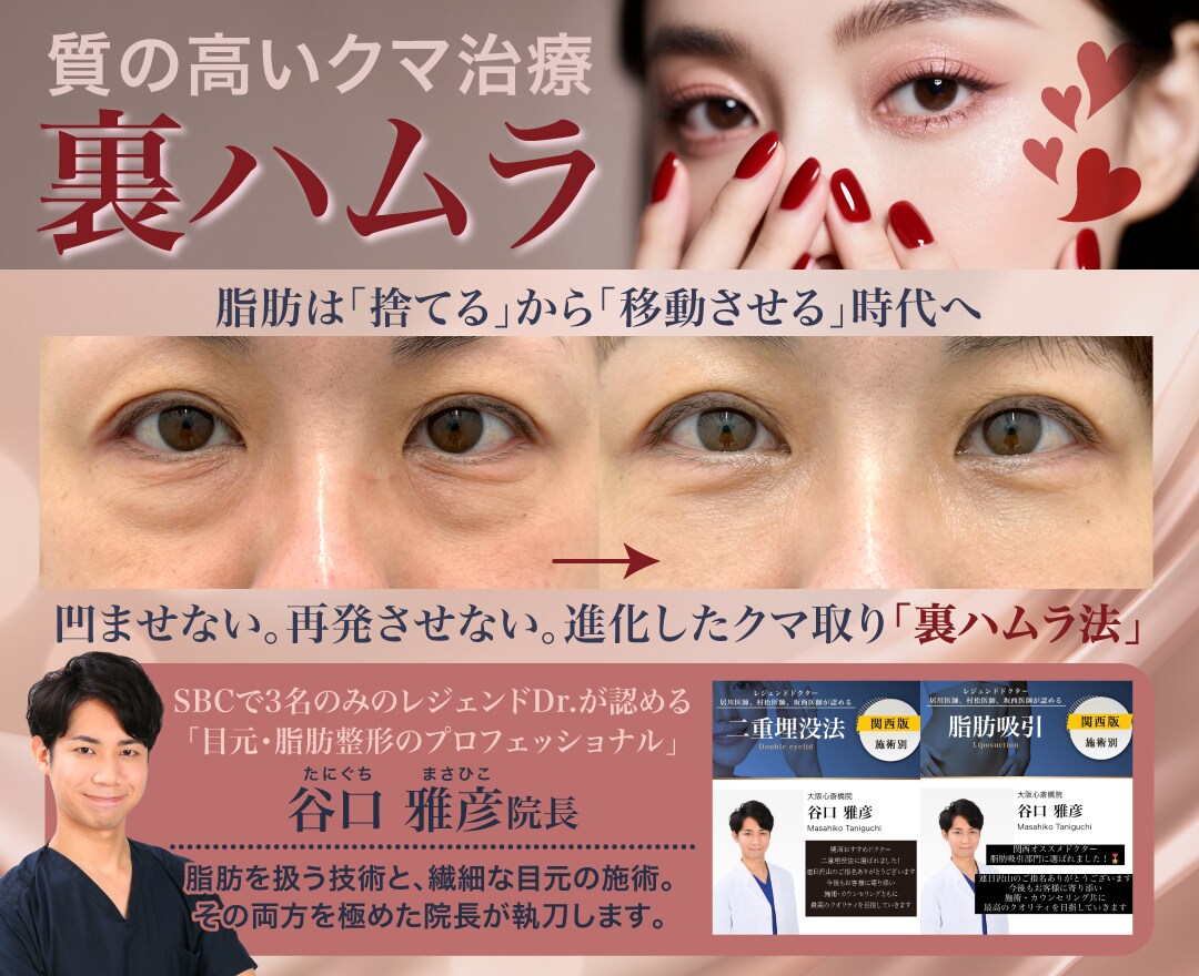 裏ハムラ