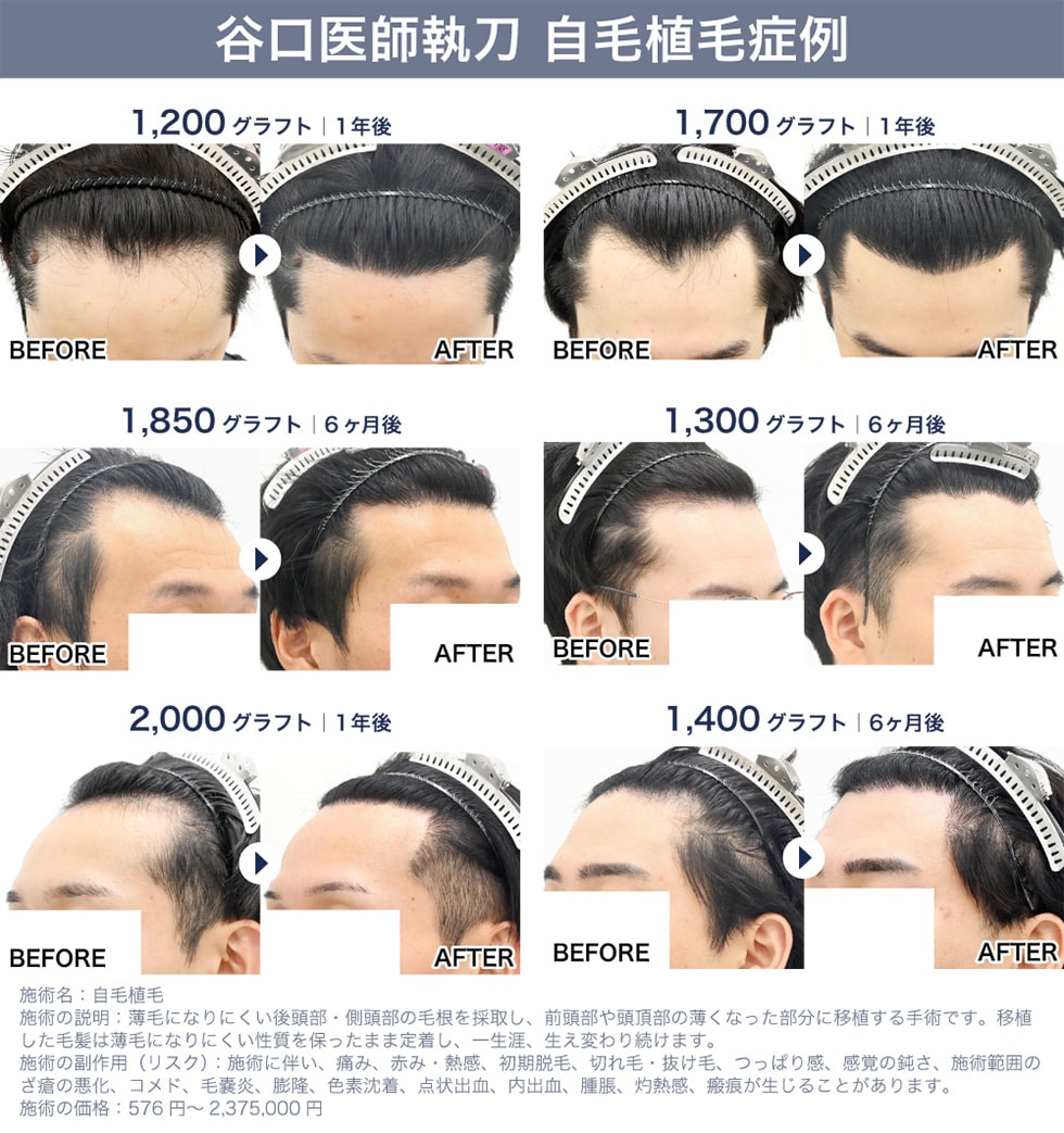 症例写真