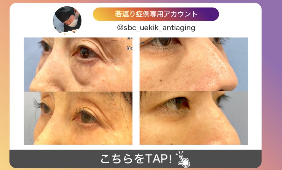 インスタ若返り
