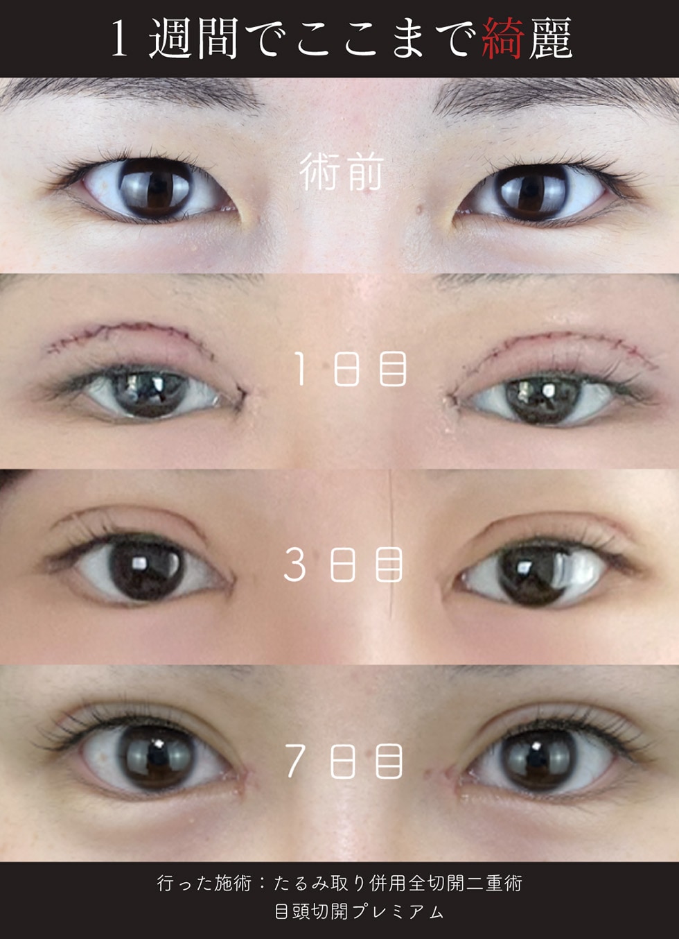 症例写真1