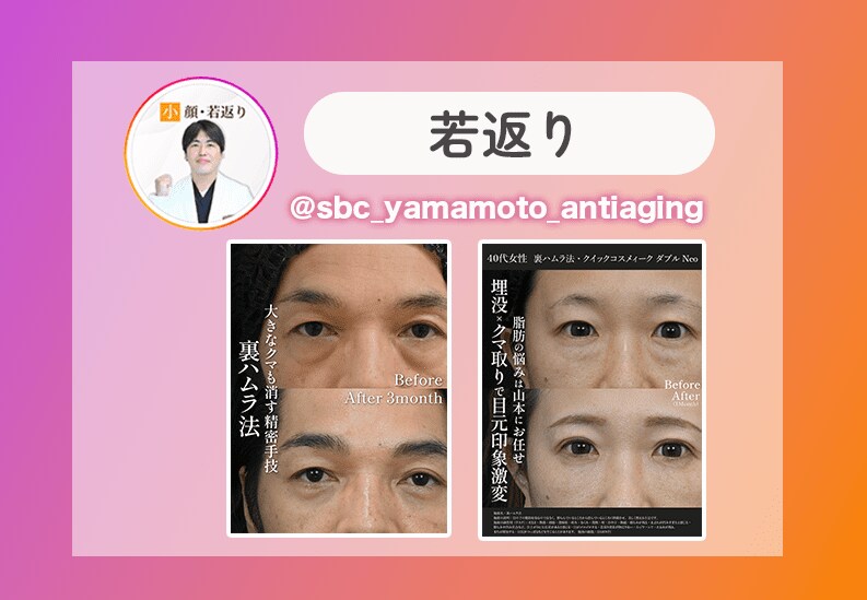 小顔PRP