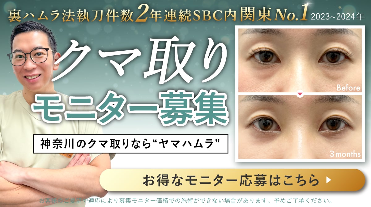 クマ取り