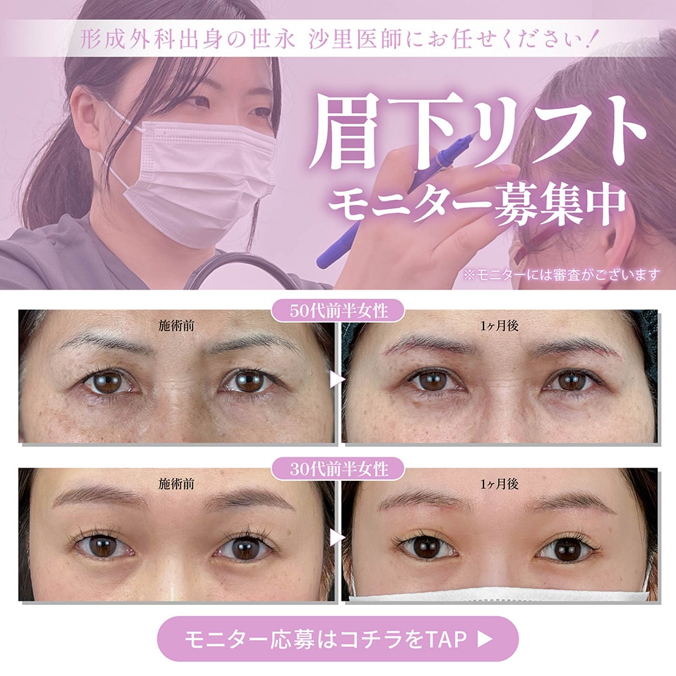 眉下リフトモニター募集中