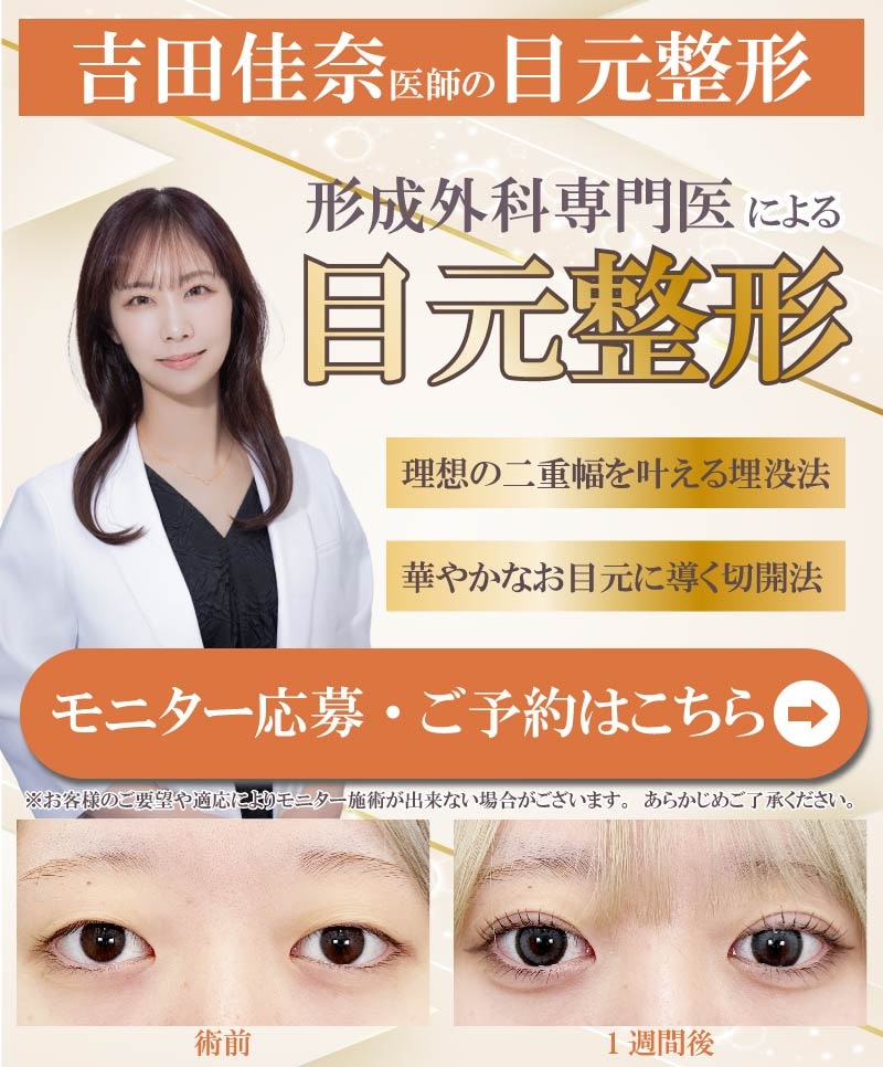 目元整形