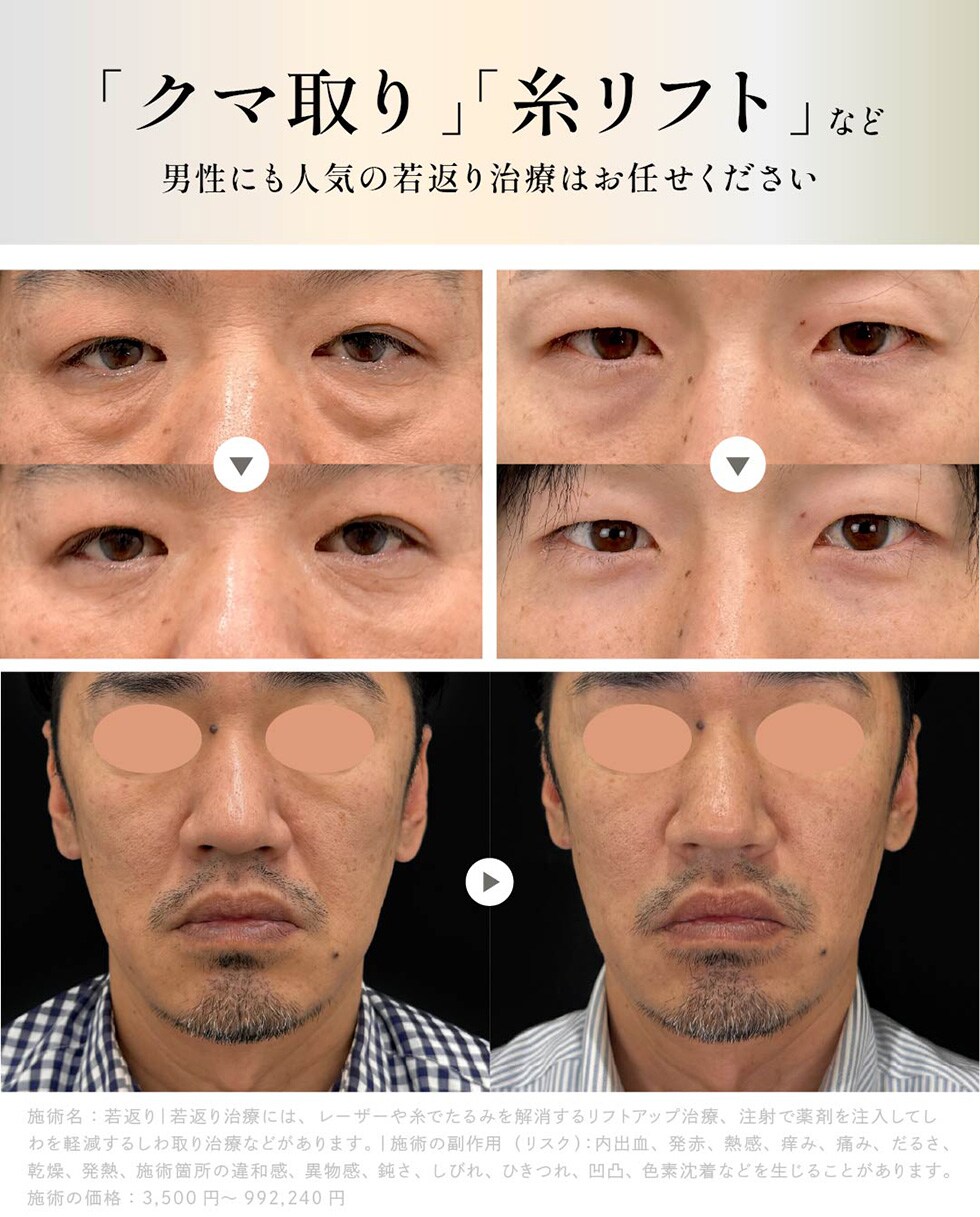 男性にも人気の若返り治療はお任せください