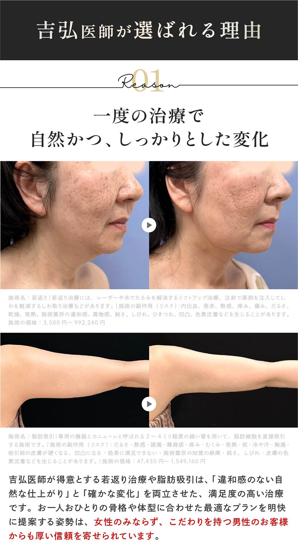 一度の治療で自然かつ、しっかりとした変化