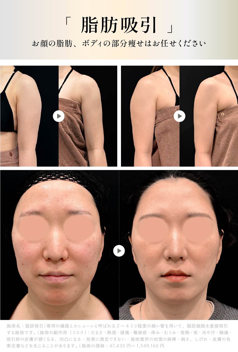 お顔の脂肪、ボディの部分痩せはお任せください