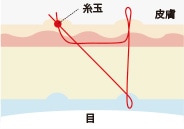 糸