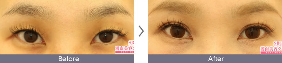 症例写真4